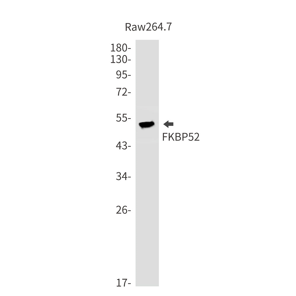 FKBP52 Rabbit Monoclonal Antibody