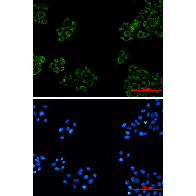 FXR1 Rabbit Monoclonal Antibody
