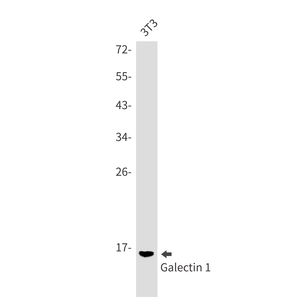 Galectin 1 Rabbit Monoclonal Antibody