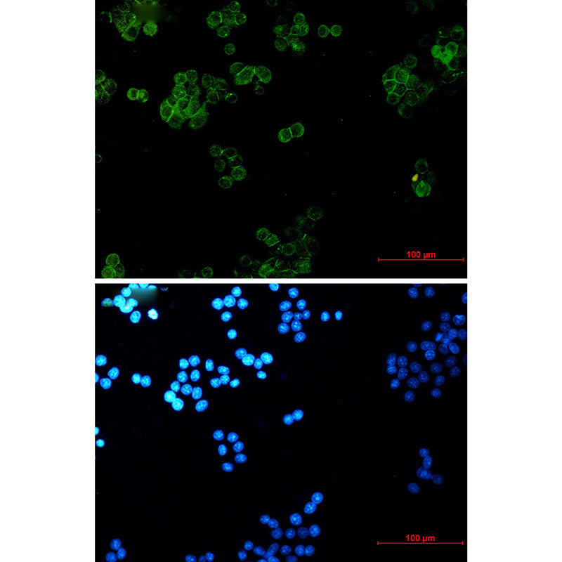 gamma Catenin Rabbit Monoclonal Antibody