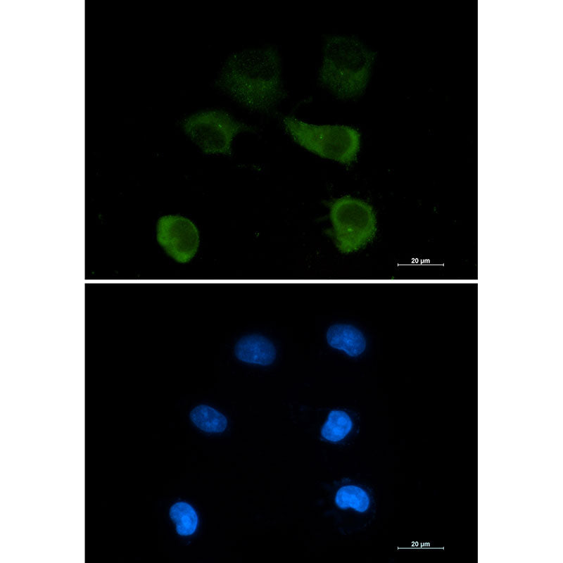 gamma Tubulin Rabbit Monoclonal Antibody