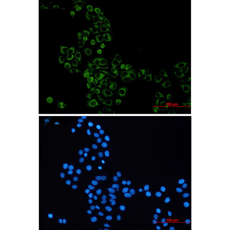 GBP1 Rabbit Monoclonal Antibody