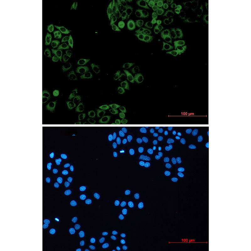GNAI2 Rabbit Monoclonal Antibody