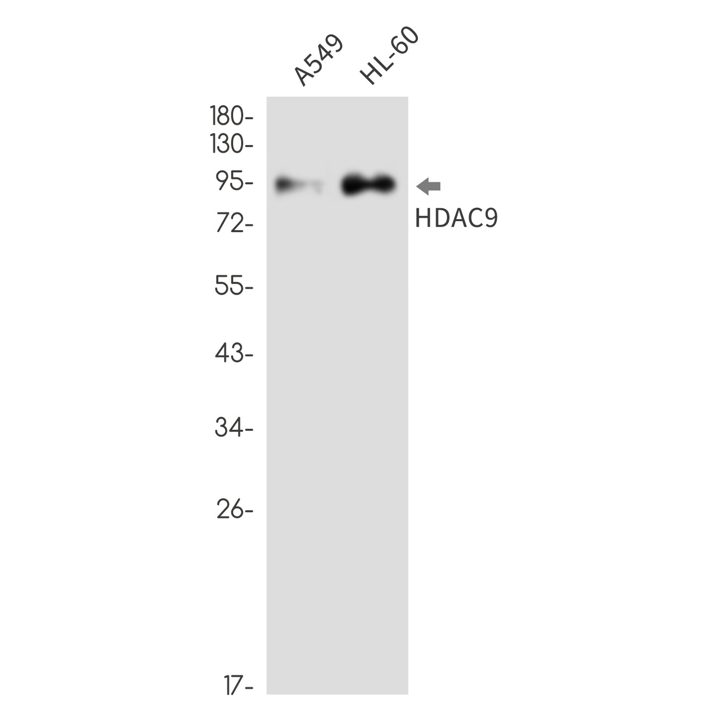 HDAC9 Rabbit Monoclonal Antibody