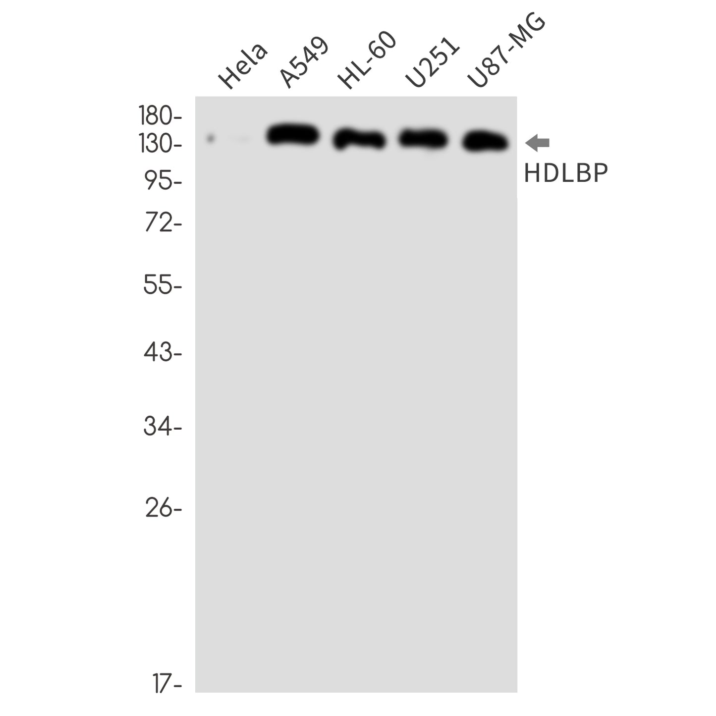 HDLBP Rabbit Monoclonal Antibody