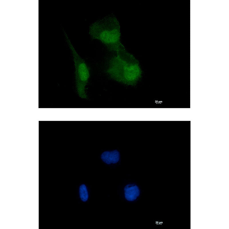 HIF1AN Rabbit Monoclonal Antibody
