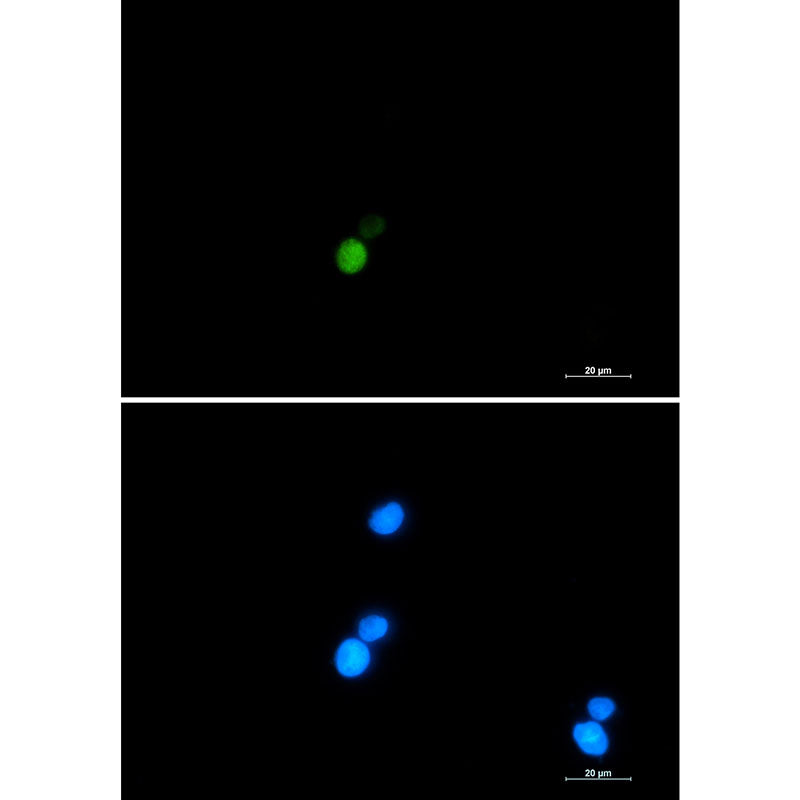 Ku70 Rabbit Monoclonal Antibody