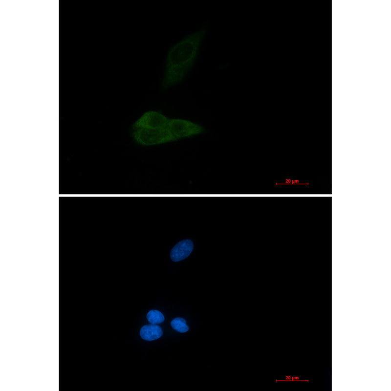 MAP3K4 Rabbit Monoclonal Antibody