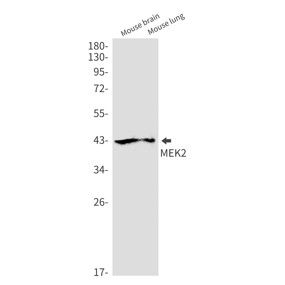 MEK2 Rabbit Monoclonal Antibody