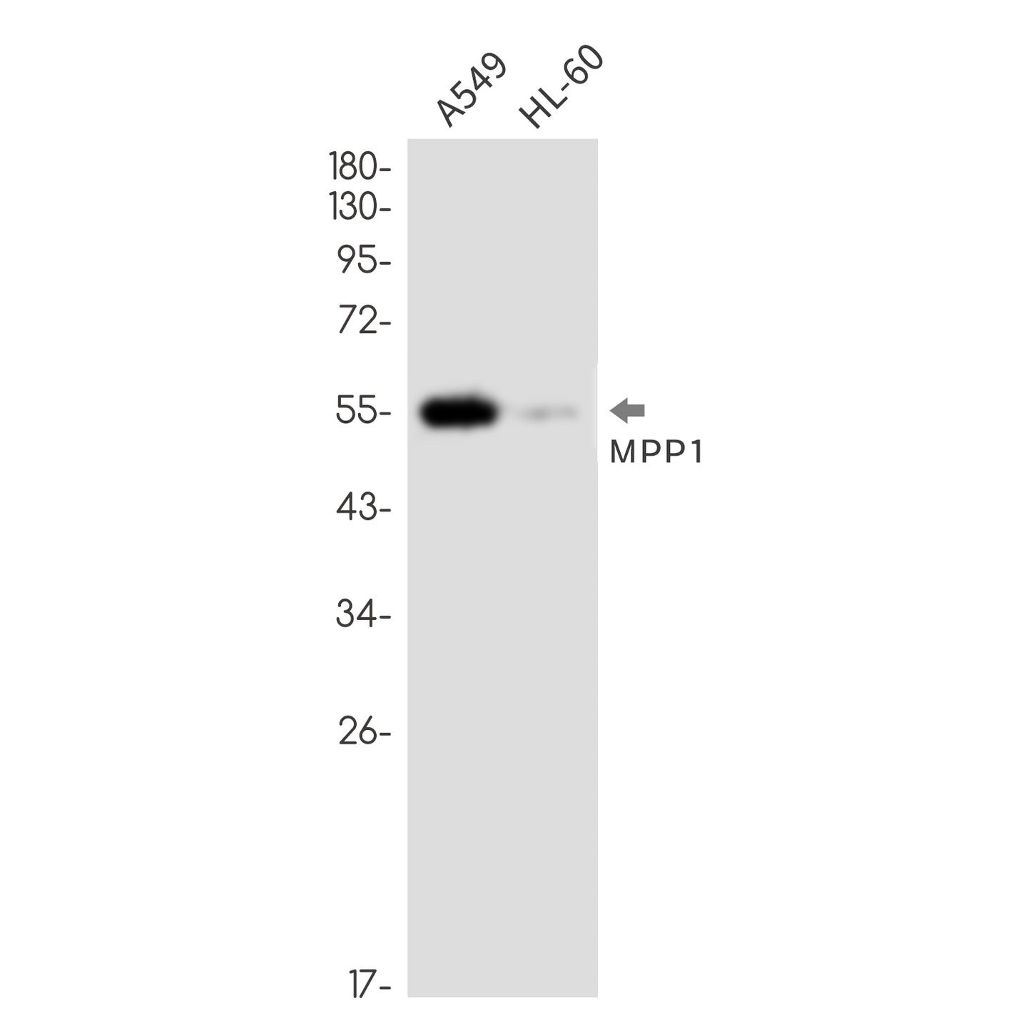 MPP1 Rabbit Monoclonal Antibody