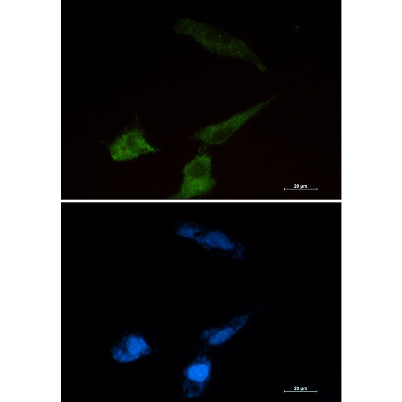 Niemann Pick C2 Rabbit Monoclonal Antibody