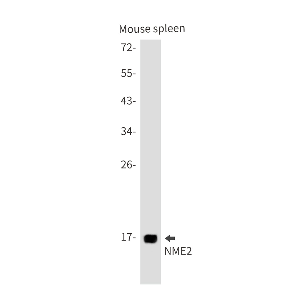 NME2 Rabbit Monoclonal Antibody