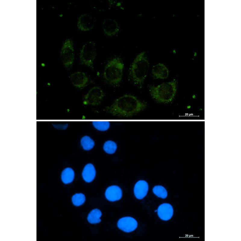 Protein CASP Rabbit Monoclonal Antibody