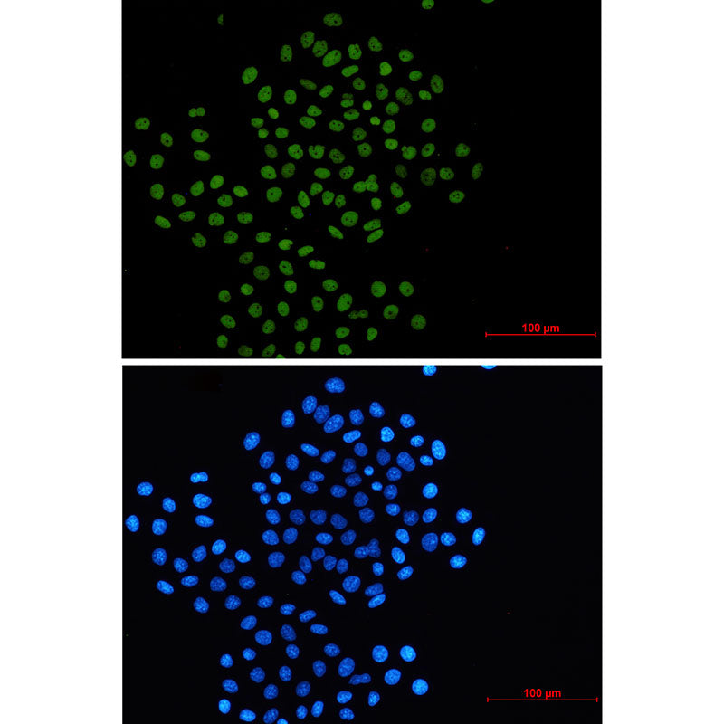 Rad21 Rabbit Monoclonal Antibody