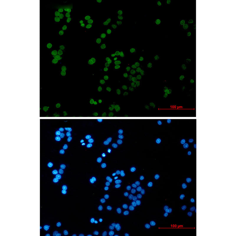 RAP80 Rabbit Monoclonal Antibody