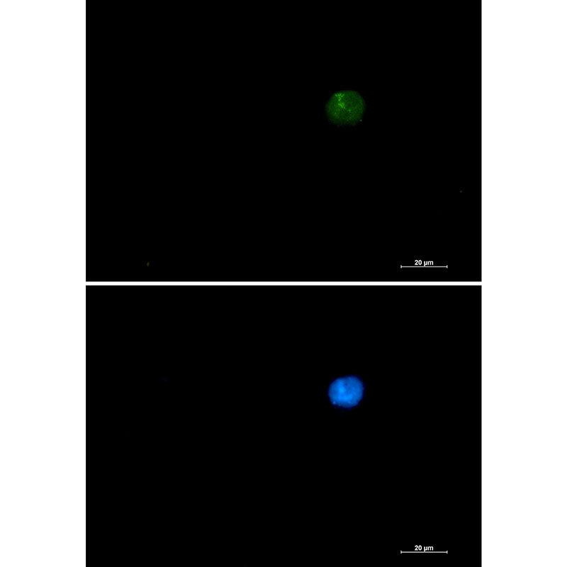 SMARCA2 Rabbit Monoclonal Antibody
