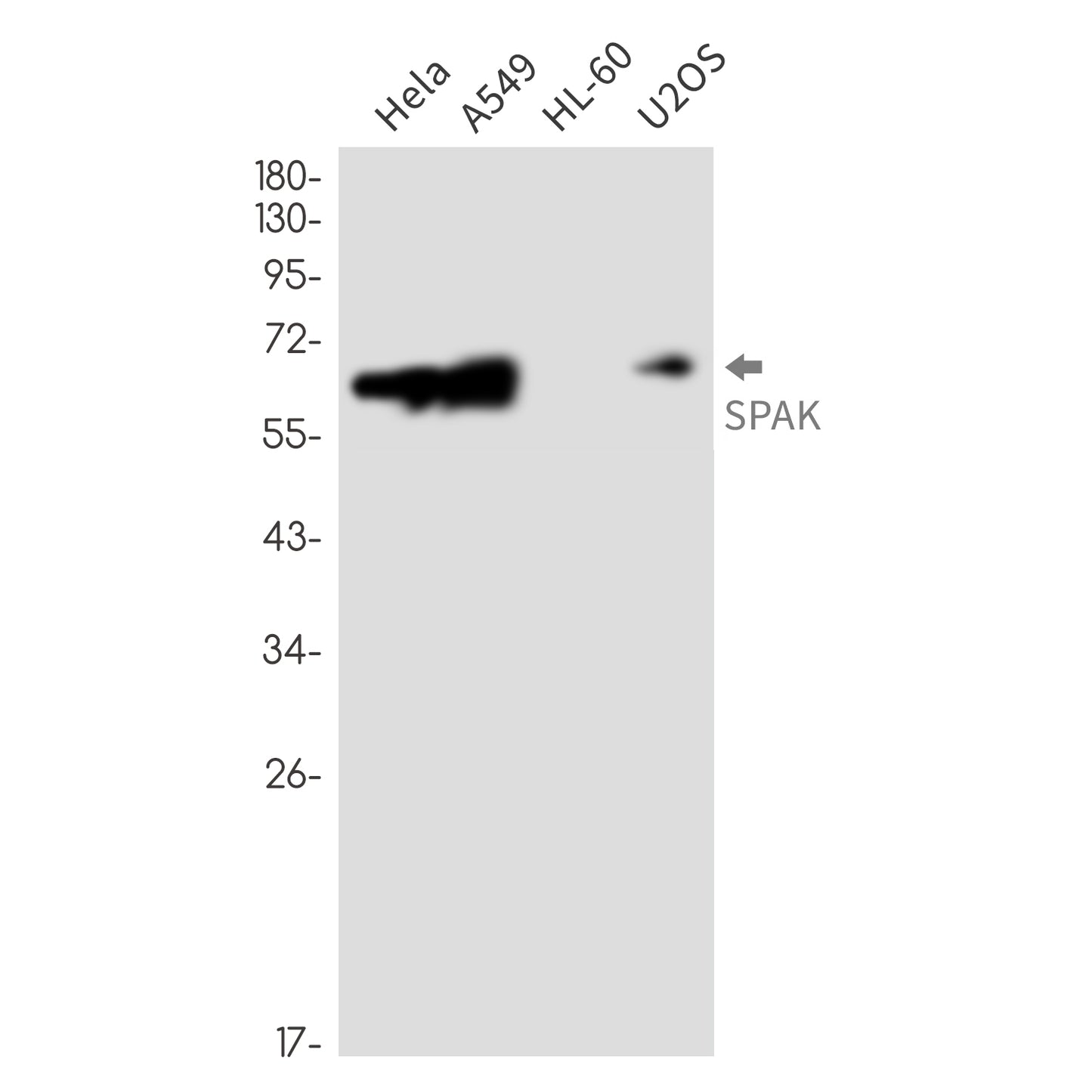SPAK Rabbit Monoclonal Antibody