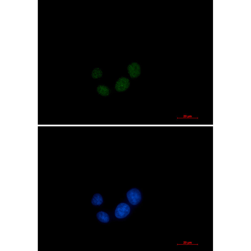 SPT5 Rabbit Monoclonal Antibody