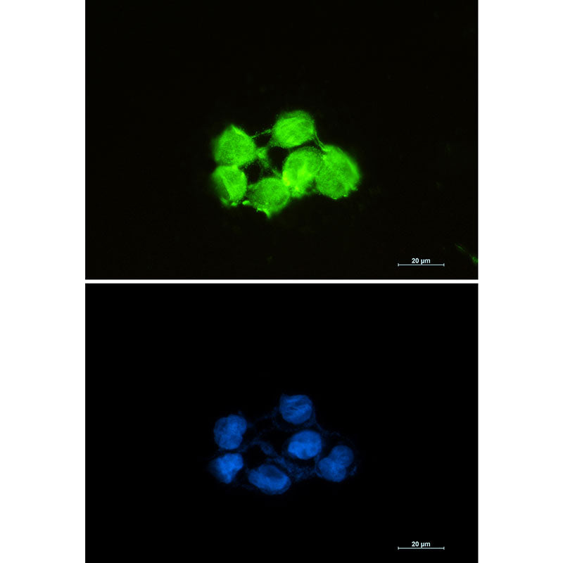 Superoxide Dismutase 1 Rabbit Monoclonal Antibody