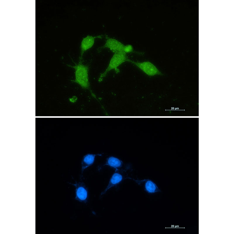 Superoxide Dismutase 1 Rabbit Monoclonal Antibody