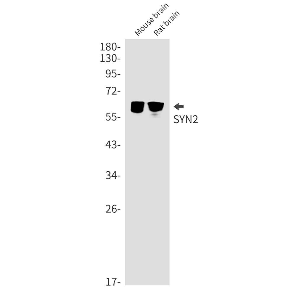 Synapsin 2 Rabbit Monoclonal Antibody