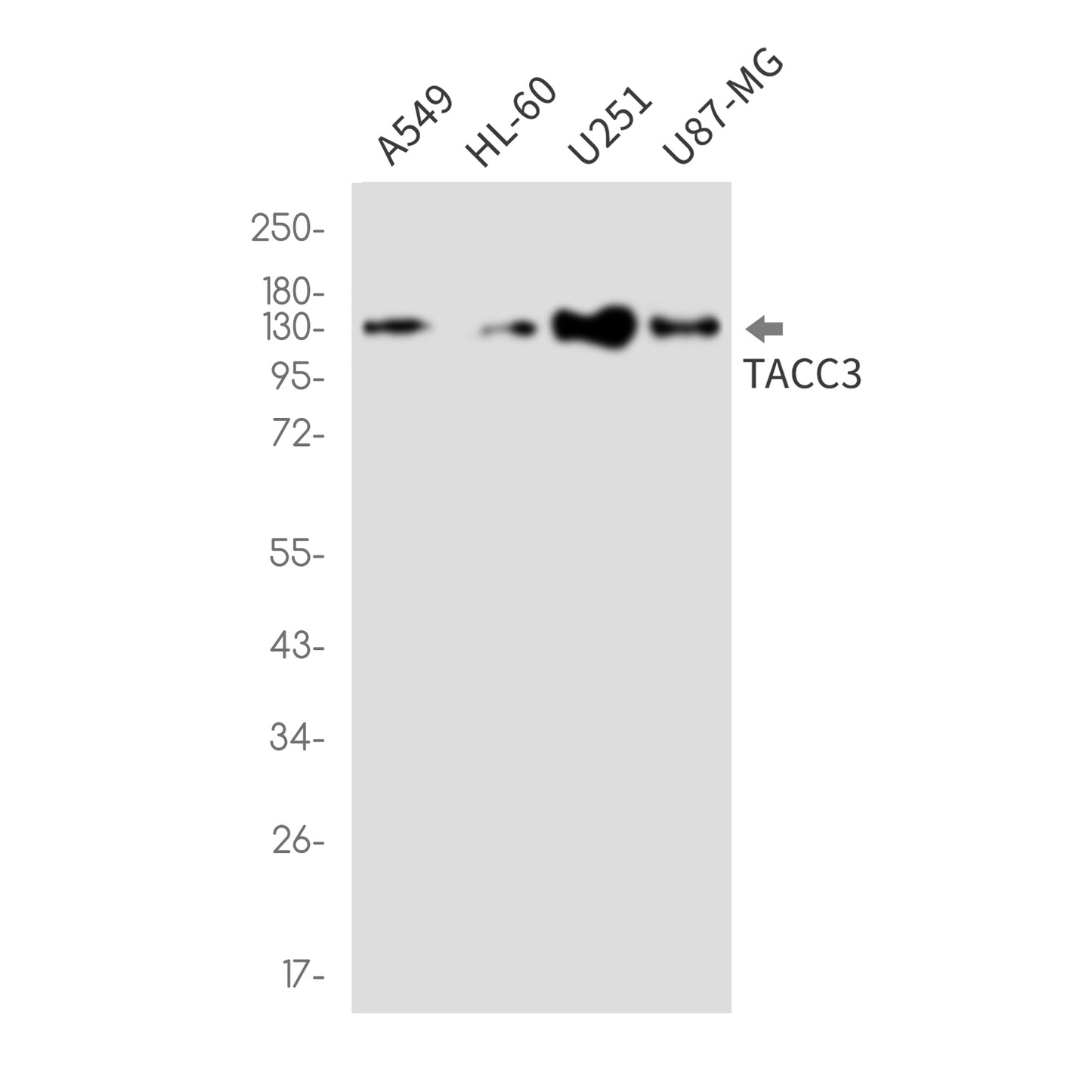TACC3 Rabbit Monoclonal Antibody