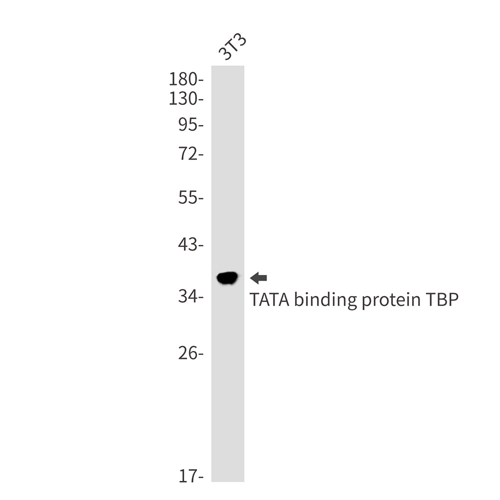 TATA Box Binding Protein Rabbit Monoclonal Antibody