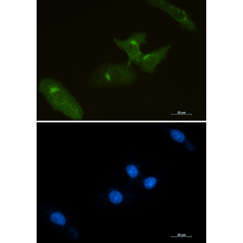 Tissue Factor Rabbit Monoclonal Antibody