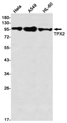 TPX2 Rabbit Monoclonal Antibody