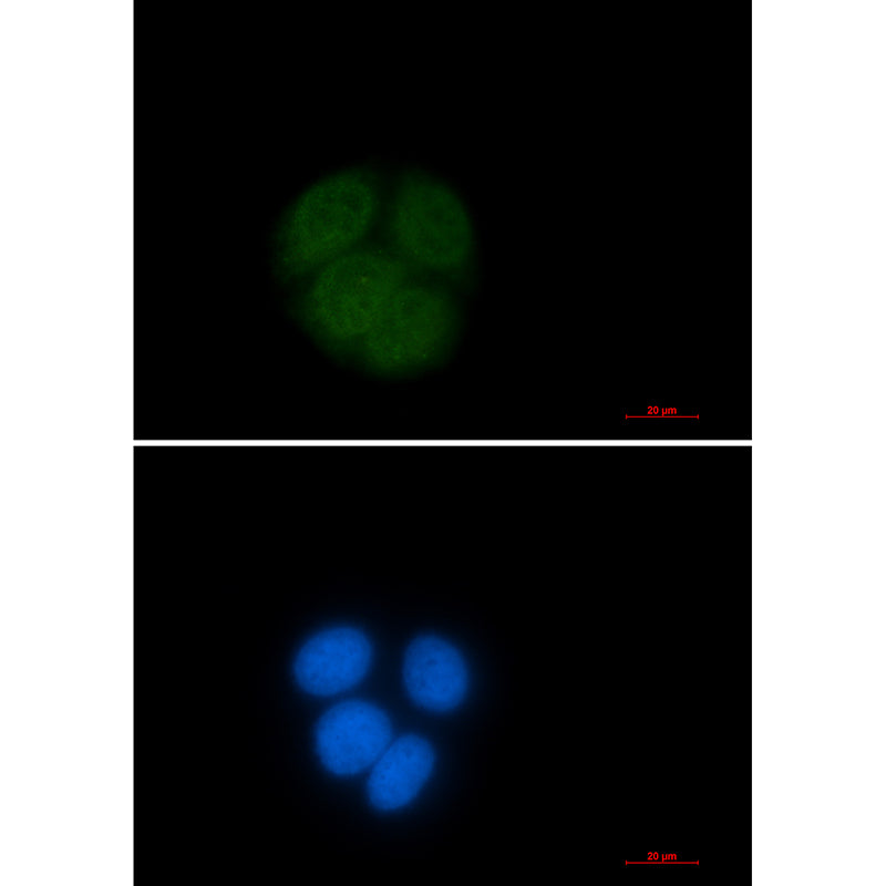 Ubiquitin Conjugating Enzyme E2 C Rabbit Monoclonal Antibody