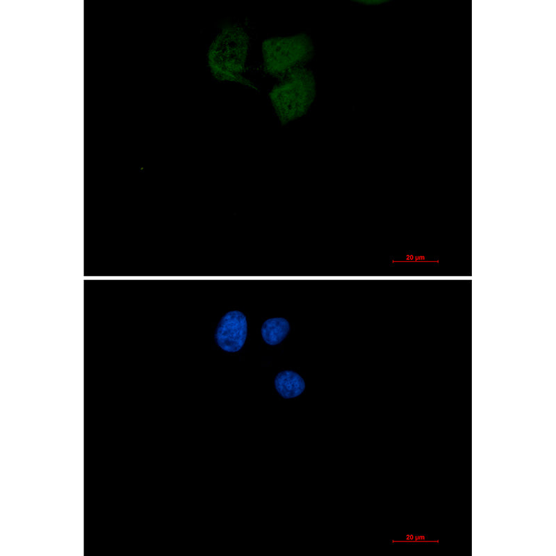 Ubiquitin Conjugating Enzyme E2 N Rabbit Monoclonal Antibody