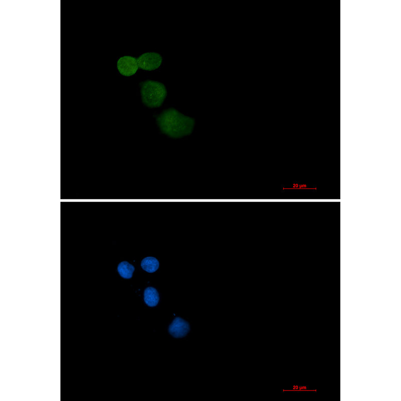 Ubiquitin Protein Ligase E3A Rabbit Monoclonal Antibody