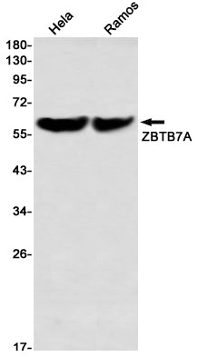 ZBTB7A Rabbit Monoclonal Antibody