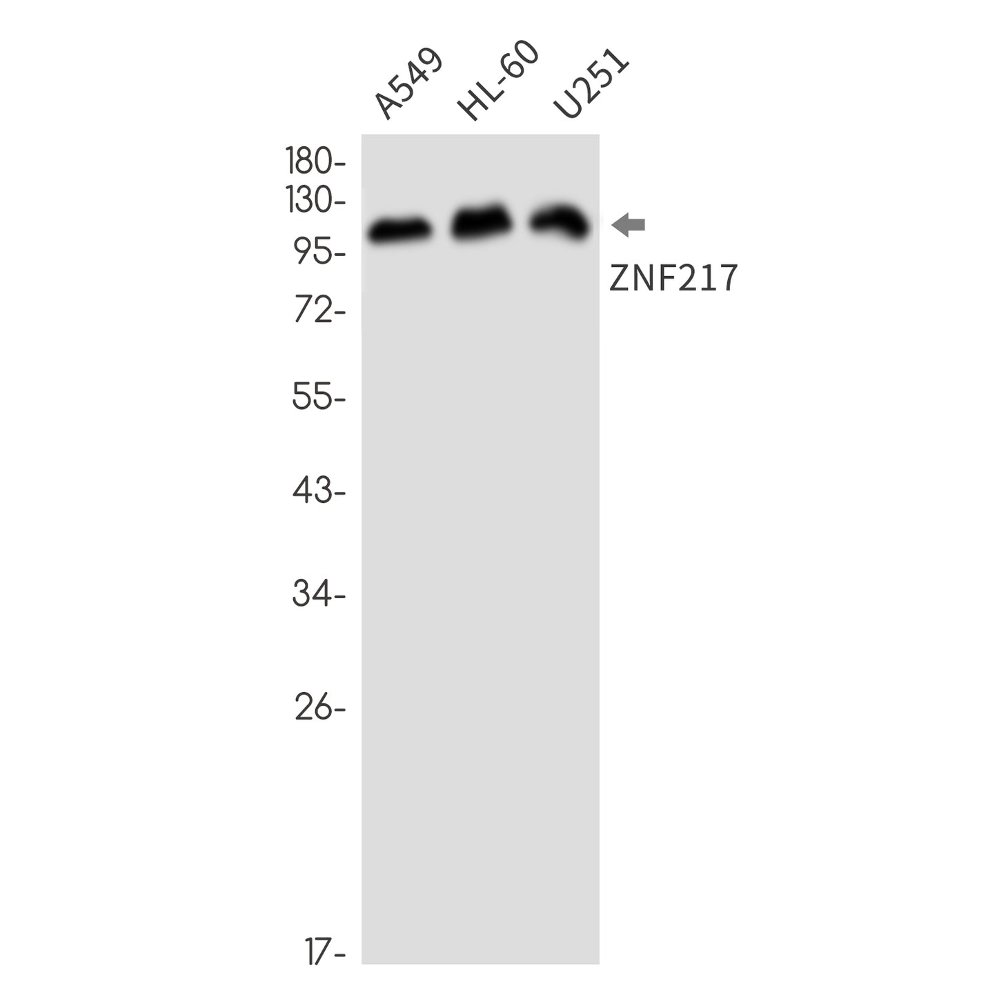 ZNF217 Rabbit Monoclonal Antibody