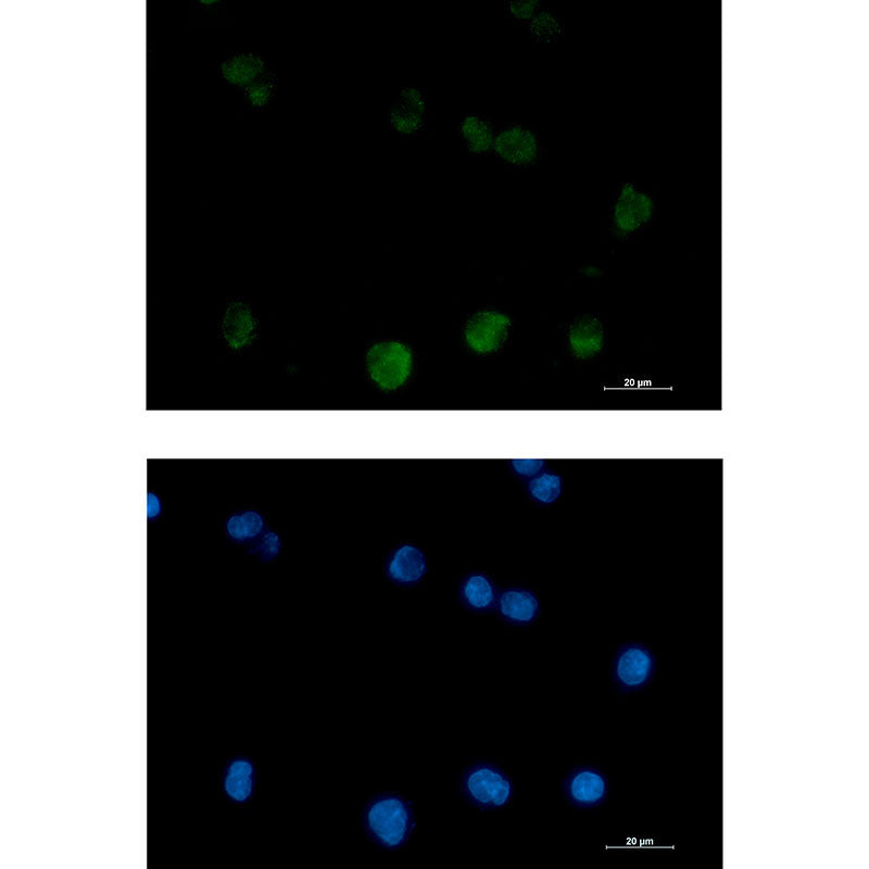 PKC beta 2 Rabbit Monoclonal Antibody