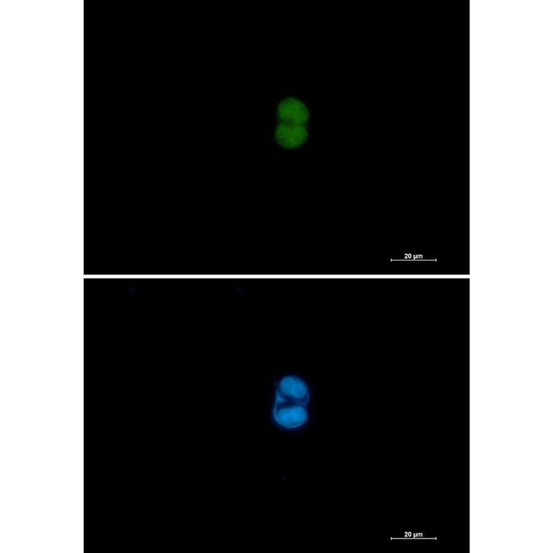 MEK3/MEK6 Rabbit Monoclonal Antibody