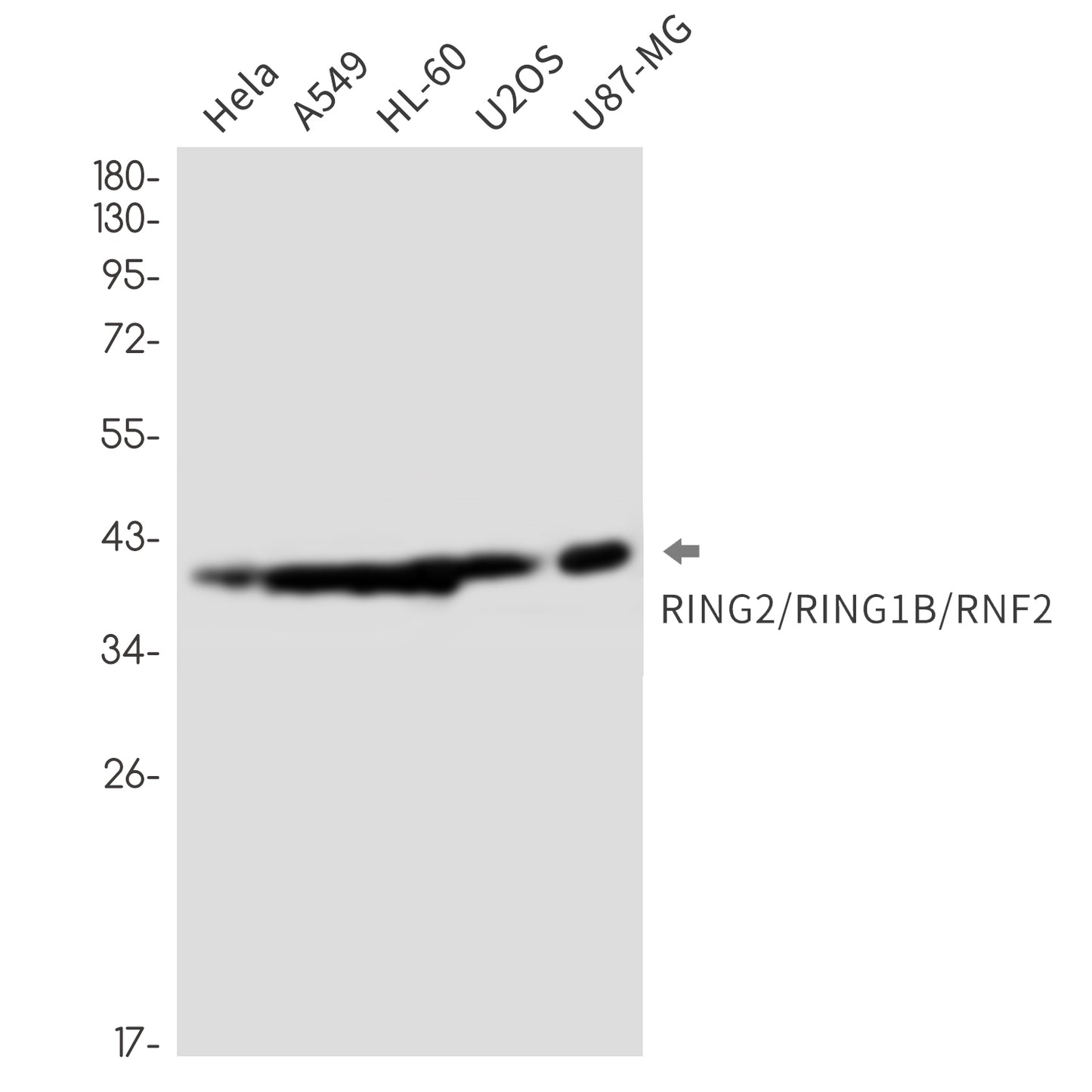 RING2 Rabbit Monoclonal Antibody