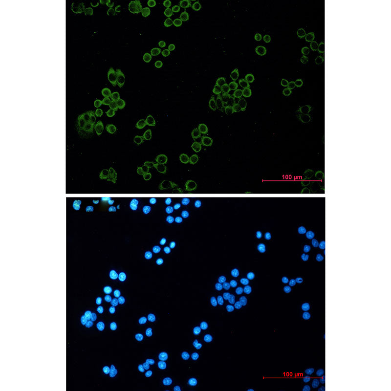 Human kappa Light Chain Rabbit Monoclonal Antibody