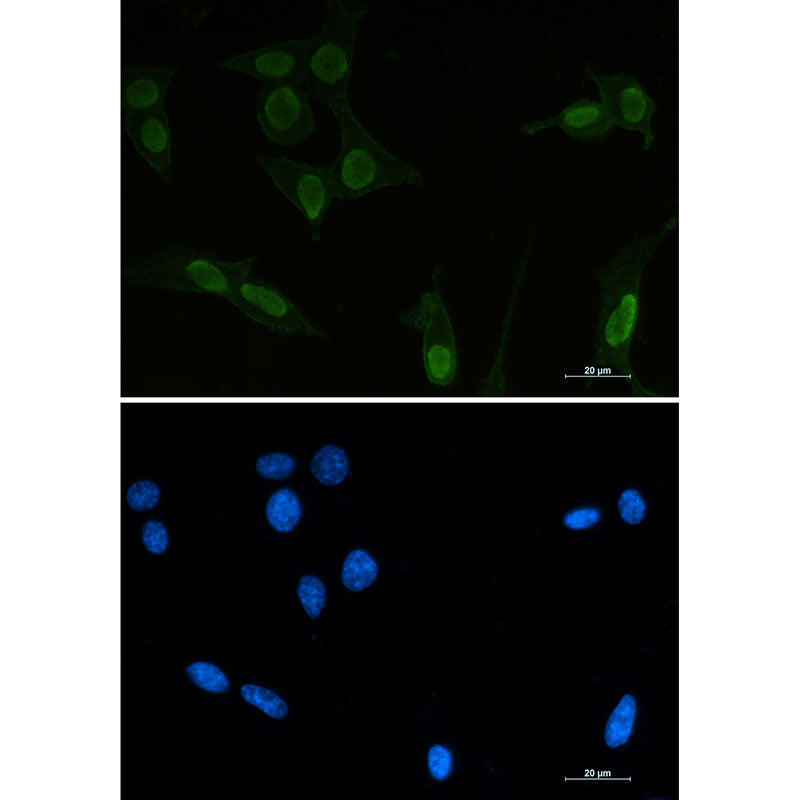 Acetyl-p53 (Lys370) Rabbit Monoclonal Antibody
