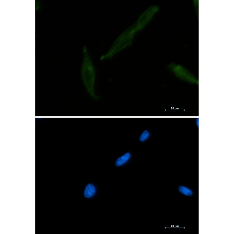 CD147 Rabbit Monoclonal Antibody
