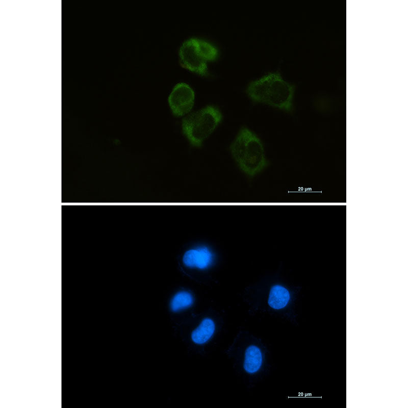 Lysozyme Rabbit Monoclonal Antibody