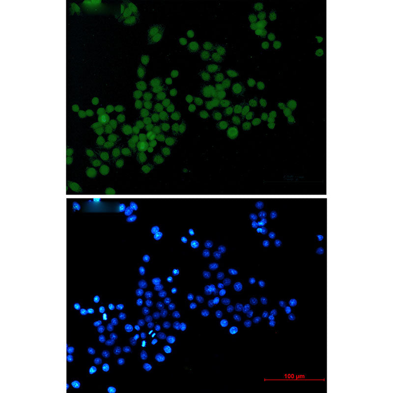 Phospho-Histone H3 (Ser10/Thr11) Rabbit Monoclonal Antibody