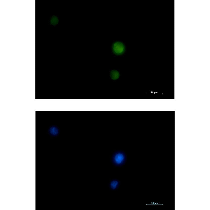 ERK1/2 Rabbit Monoclonal Antibody