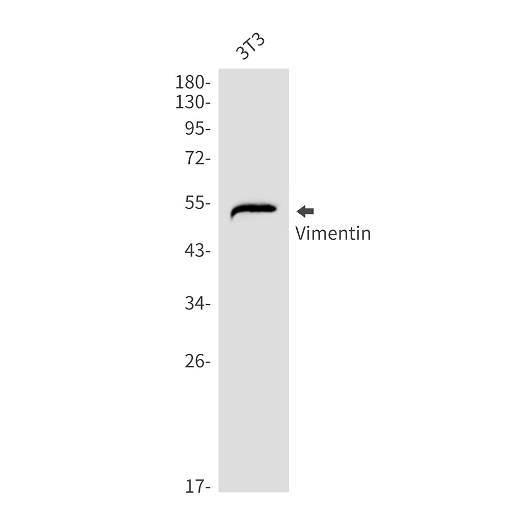 Vimentin Rabbit Monoclonal Antibody