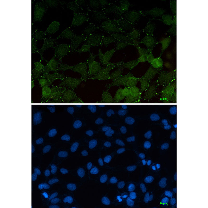 beta Catenin Rabbit Monoclonal Antibody