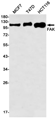 FAK Rabbit Monoclonal Antibody
