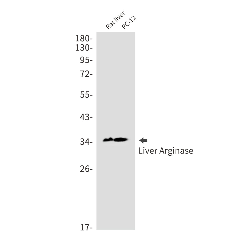 Liver Arginase Rabbit Monoclonal Antibody