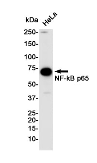 NF-KB p65 Rabbit Monoclonal Antibody
