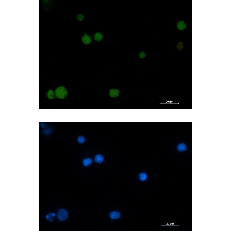 Rad51 Rabbit Monoclonal Antibody