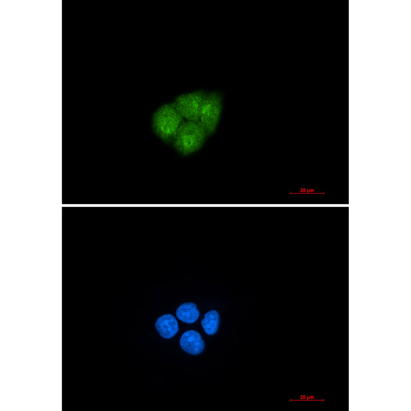 Smad2 Rabbit Monoclonal Antibody